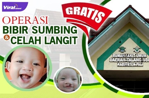 RSUD PALI gelar oprasi bibir sumbing dan celah langit untuk anak-anak. Foto : viralsumsel.com/eko